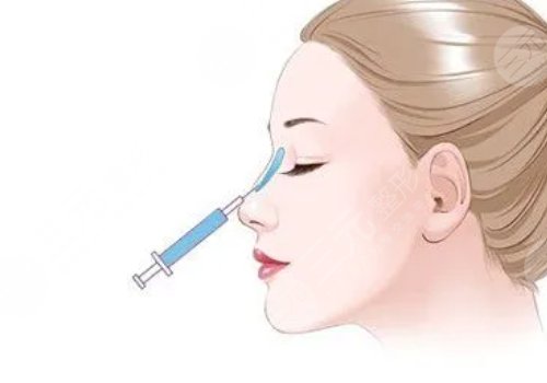 愛貝芙隆鼻會(huì)變寬嗎