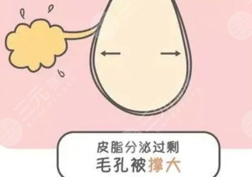 男性毛孔粗大油膩怎么改良？