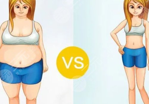 產(chǎn)后吸脂減肥好嗎？