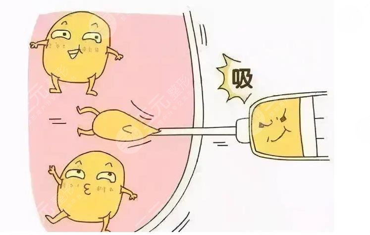 產(chǎn)后吸脂減肥好嗎？