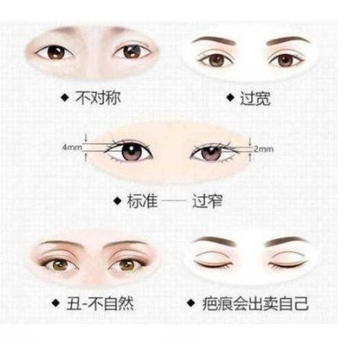 雙眼皮修復(fù)大概多少錢呢？