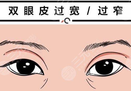 雙眼皮修復(fù)大概多少錢呢？