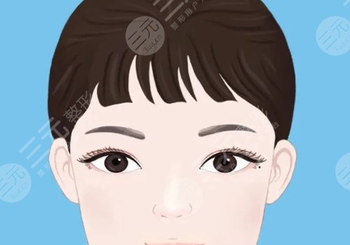 雙眼皮修復(fù)大概多少錢呢？