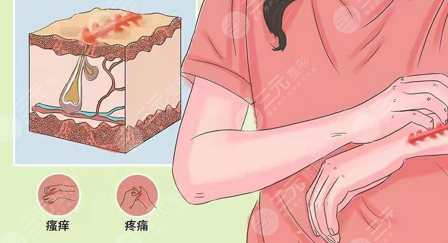 有傷疤怎么去掉？