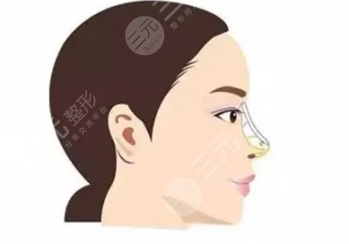 鼻梁山根低怎么辦？