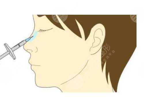 鼻梁山根低怎么辦？