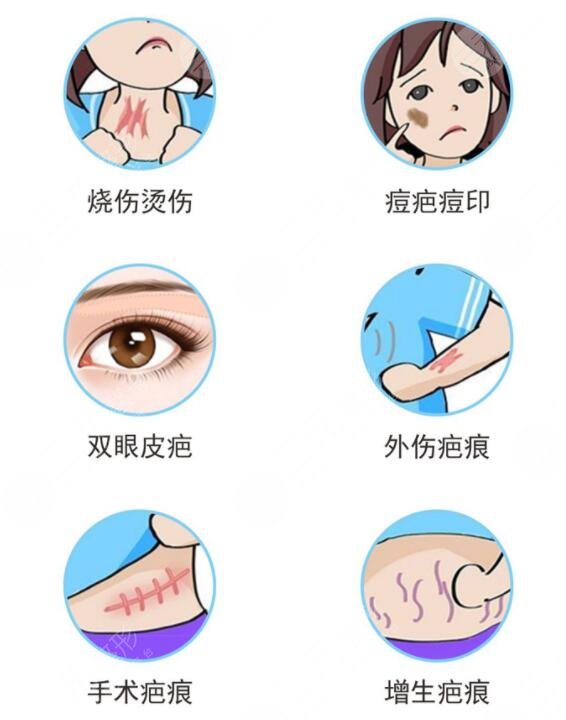像素激光去疤術(shù)后注意事項(xiàng)