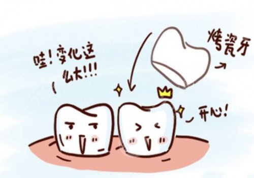 鈦合金烤瓷牙多少錢一顆？