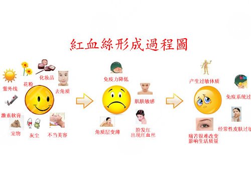 臉上長紅血絲怎么去掉？