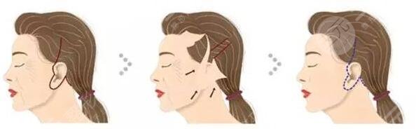 八大處整形醫(yī)院開展項(xiàng)目