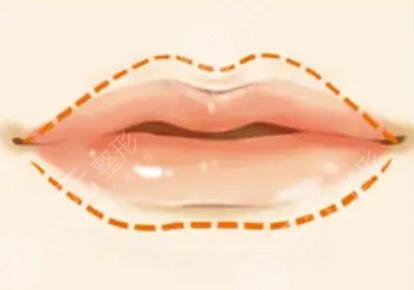 嘴唇角形有什么風險?