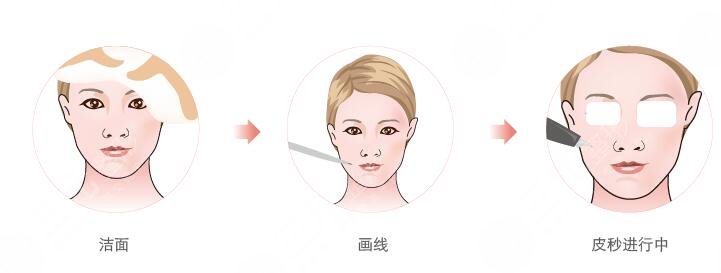 美白注射，水光注射管用嗎?