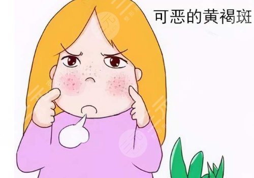 怎樣去除面部黃褐斑有效？