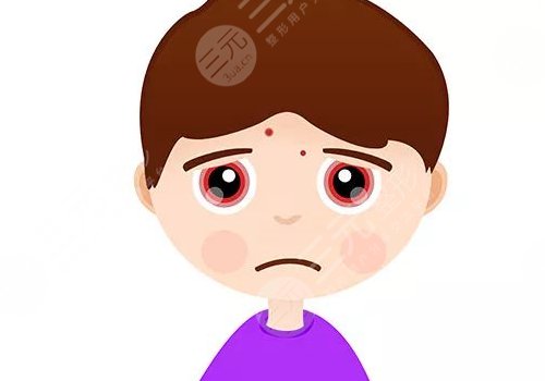 臉上有痘印怎么辦才能去掉呢？