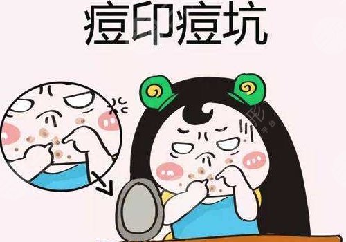 臉上有痘印怎么辦才能去掉呢？