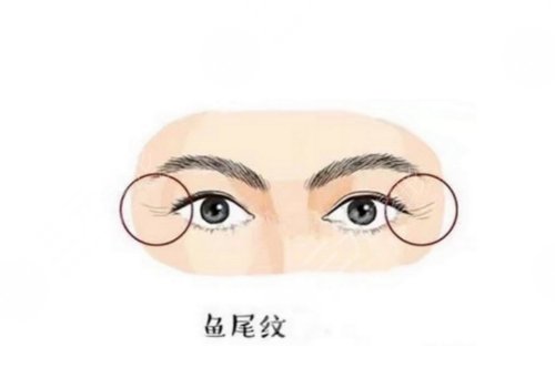 怎么樣去除眼部皺紋？