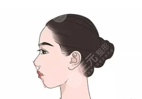 上海美聯(lián)臣(愉悅薇萊醫(yī)療美容醫(yī)院)做下頜角怎么樣?