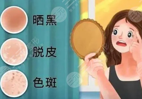 臉上的色斑怎么去掉(淡化)？