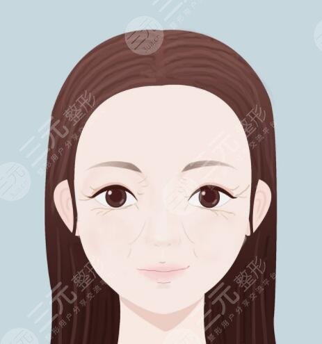 怎樣防止魚(yú)尾紋及保養(yǎng)方法，分為醫(yī)美和非醫(yī)美兩種方案！