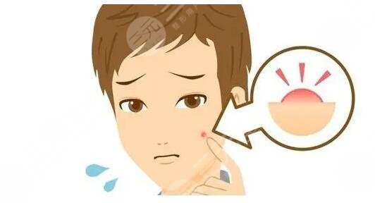 緩解青春痘費(fèi)用多少錢？哪些醫(yī)美方法見效快？