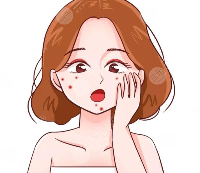 祛痘有效方法有效可行，護理注意事項|內(nèi)調(diào)