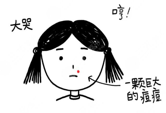 臉上生長了痘痘應該注意哪些問題?