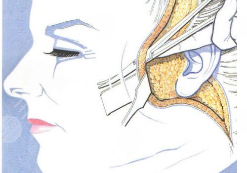 多維除皺真的有用嗎？