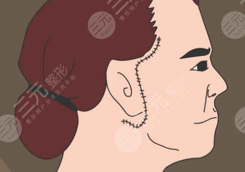 多維除皺真的有用嗎？