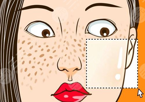 激光祛斑后反黑怎樣能快速消除？