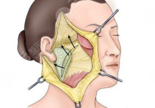 柳民熙醫(yī)生坐診醫(yī)院
