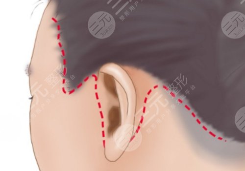 柳民熙醫(yī)生