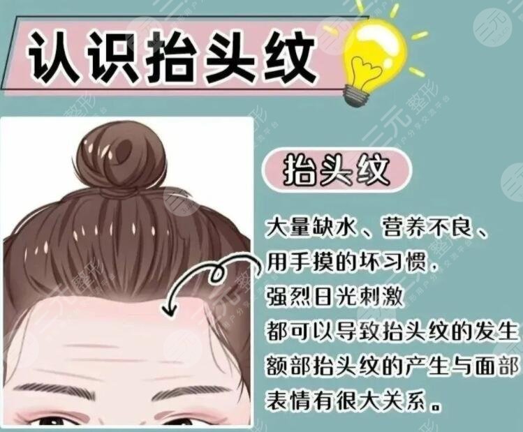 抬頭紋整形多少錢一般？哪些方法可以改良抬頭紋？