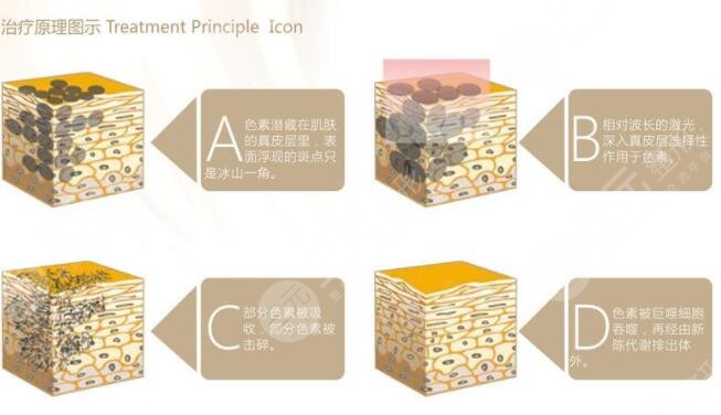 黑臉娃娃的價格貴不貴?