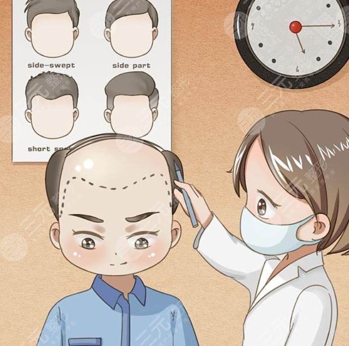 植發(fā)價格是多少