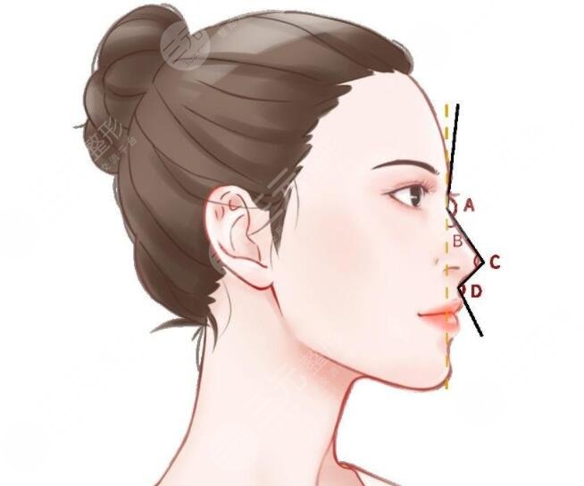 玻尿酸隆鼻的價(jià)格受到了哪些因素影響?