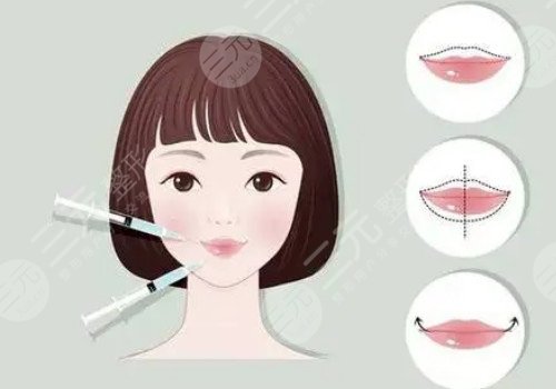 唇部注射玻尿酸需要注意什么？