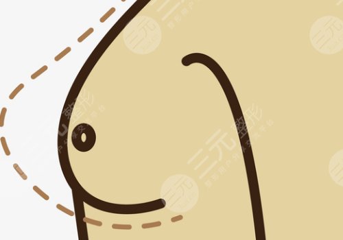 隆胸乳暈切口的優(yōu)缺點