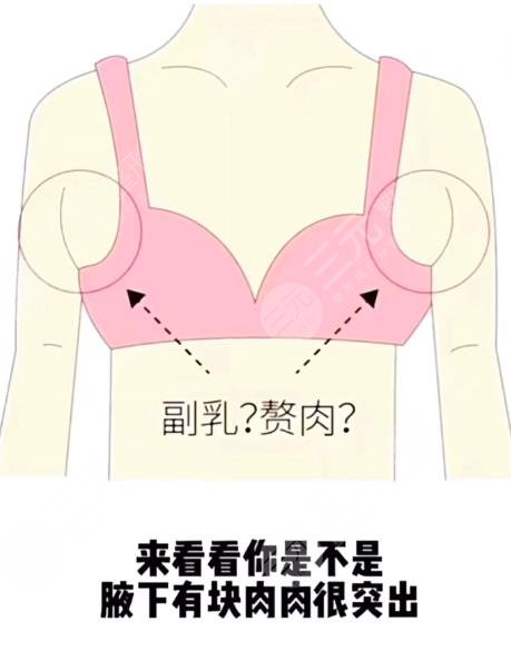 6大腋下副乳運(yùn)動(dòng)消除方法！4分鐘消除副乳！甩掉拜拜肉！