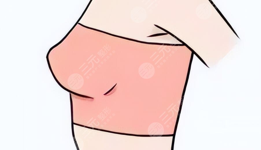 極速豐胸和普通豐胸一樣嗎？原理是怎么回事？相較優(yōu)勢(shì)是什么？