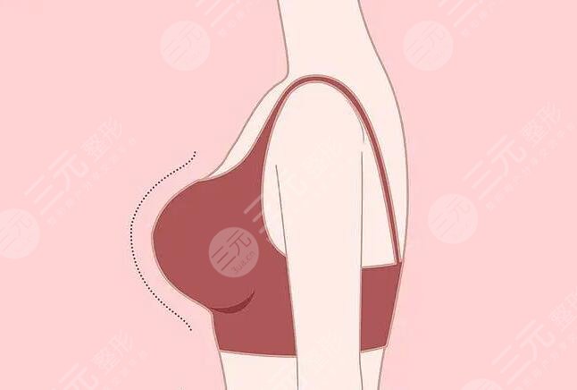 極速豐胸手術(shù)大概的價(jià)格是多少?