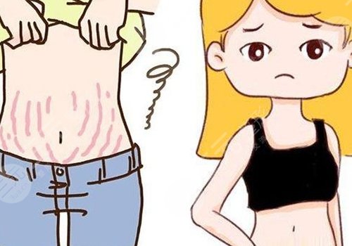 腹部拉皮手術費多少錢？
