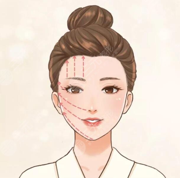 射頻緊膚可以維持多久？做幾次才有效果？術(shù)后注意事項