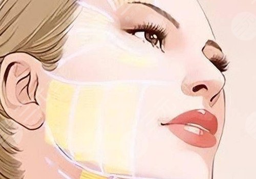 王志軍面部年輕化怎么樣?