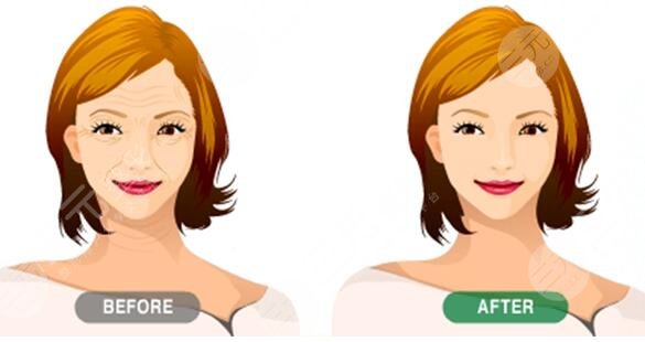 柳民熙醫(yī)生擅長項目