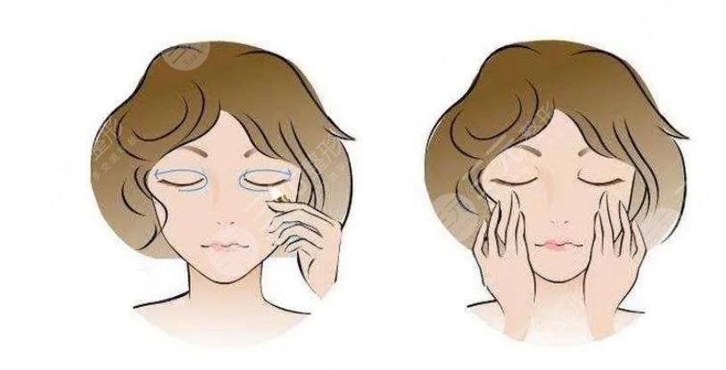 內(nèi)切眼袋多久恢復(fù)正常