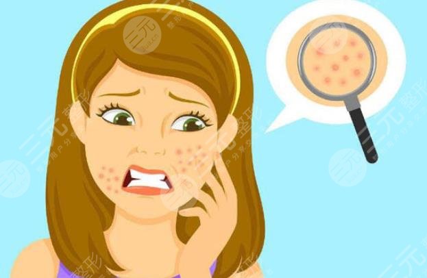 為什么會長閉合性粉刺