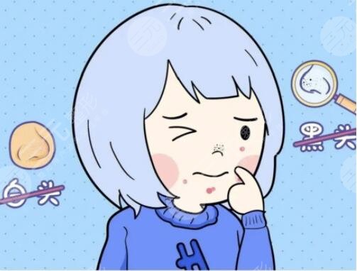 去黑頭有效的方法有哪些起效快速？5個好用的方法，一周一次