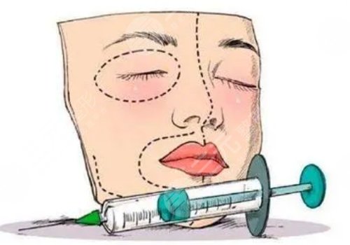 微調整形都有什么項目?