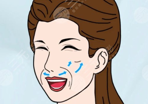 電波拉皮和熱瑪吉的區(qū)別在哪？