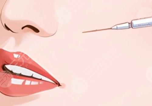 臉部微調(diào)大概多少錢？包括哪些項(xiàng)目？